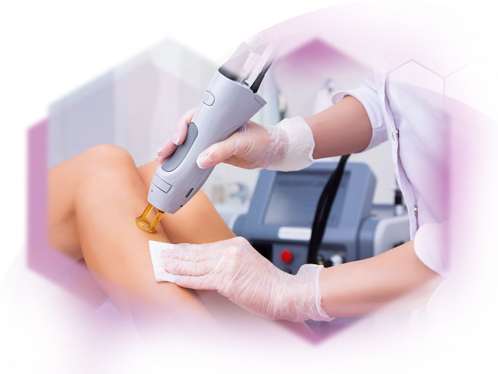 Photo treatment alexandrite laser
