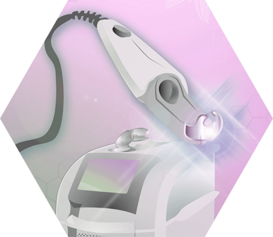 Alexandrite laser Illustration