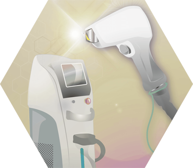 Diode laser Illustration