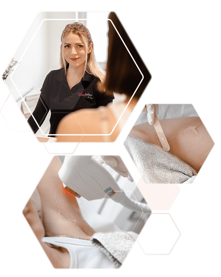 Top Service und Technologie bei Haarfreiheit Wiesbaden