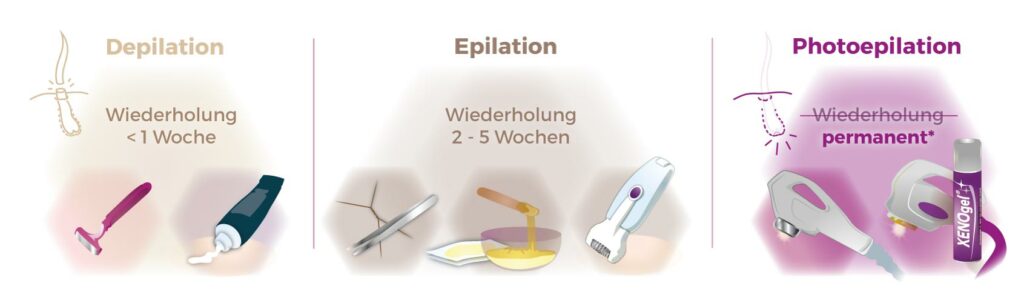 Infografik Vergleich Haarentfernungsmethoden