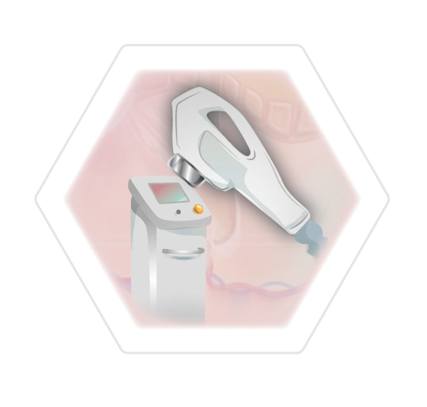 Illustration Technologie dauerhafte Haarentfernung IPL