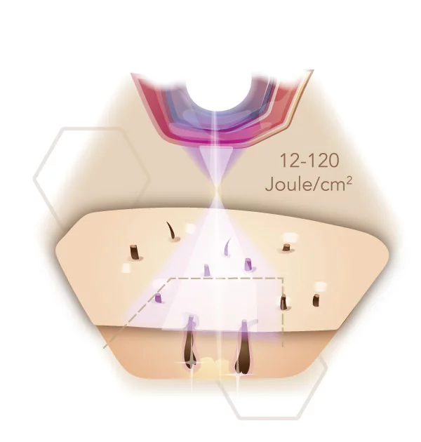 IPL Infografik Energielevel