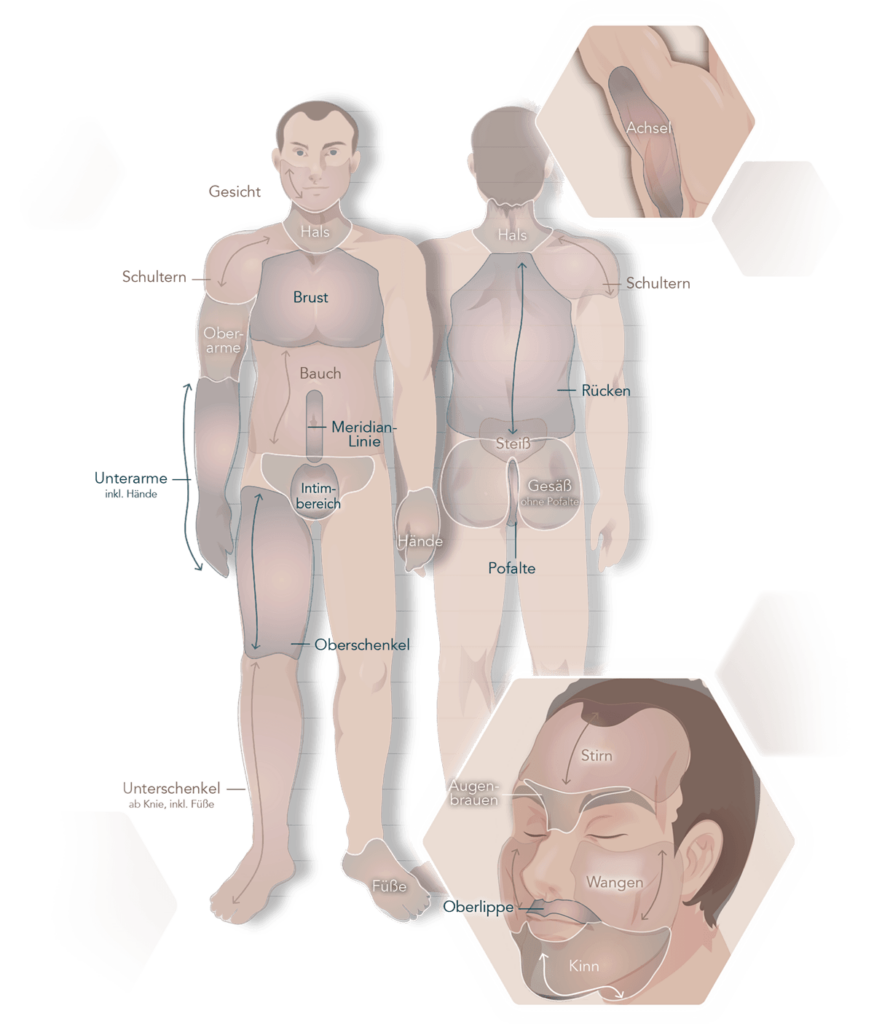 Infografik Körperregionen beim Mann